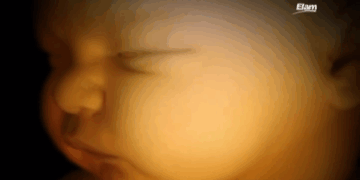 Hyde Amendment Must be Expanded to Stop Obamacare From Funding Abortions