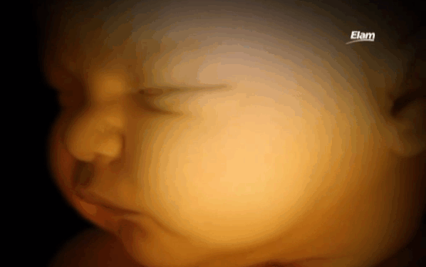 Hyde Amendment Must be Expanded to Stop Obamacare From Funding Abortions