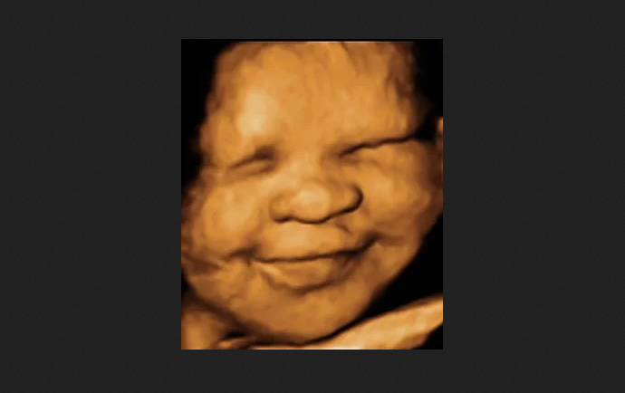 Judge Dismisses Satanic Temple’s Lawsuit Against Idaho Abortion Ban