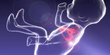 North Dakota Supreme Court Upholds Abortion Ban