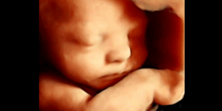 Politicians in Scotland Want to Legalize Abortions Up to Birth