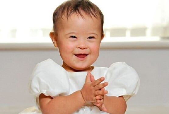 Some Countries Kill 95% of Babies With Down Syndrome in Abortion