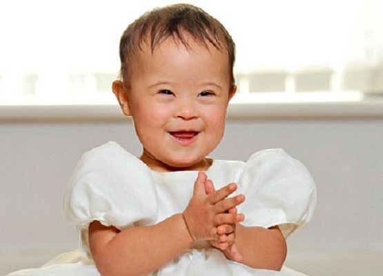 Some Countries Kill 95% of Babies With Down Syndrome in Abortion