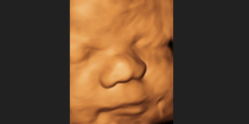 State Legislators From Across America Commit to Protecting Babies From Abortion