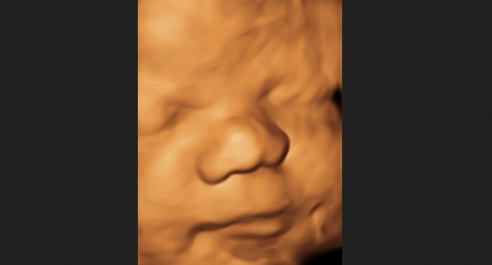 State Legislators From Across America Commit to Protecting Babies From Abortion