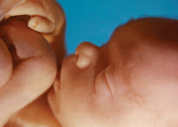 Trump Admin Will Classify Abortion as a Human Rights Abuse