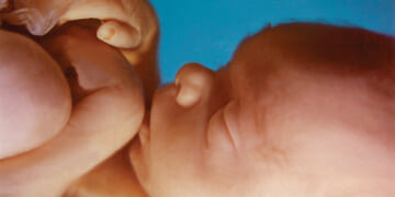 Trump Admin Will Classify Abortion as a Human Rights Abuse