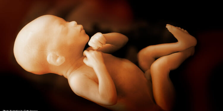 Ultrasound Photos Prove Abortions Kill Babies