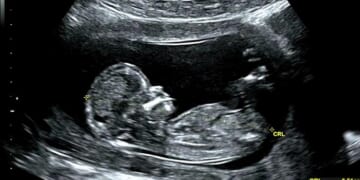 Unborn Babies are Not Just Human Beings. They’re Persons