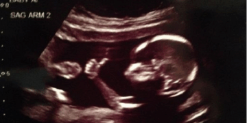 100 Abortion Centers Have Closed Since Roe Was Overturned