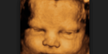 60% of Babies Killed in Abortions are Killed With Abortion Pills