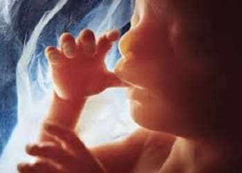 86 Cities Across America Have Banned Abortions