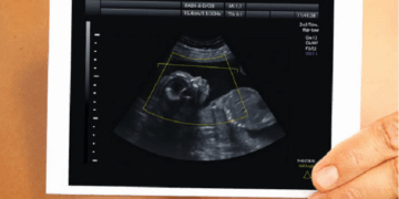 CDC Won’t Release Updated Abortion Figures Until Next Year