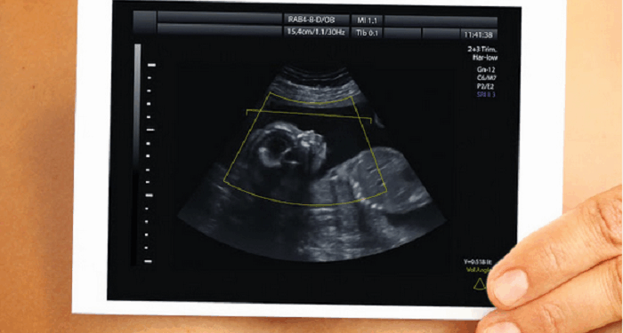 CDC Won’t Release Updated Abortion Figures Until Next Year