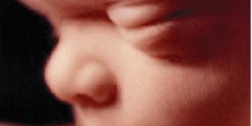 Here's Why the CDC is Not Publishing Annual Abortion Data