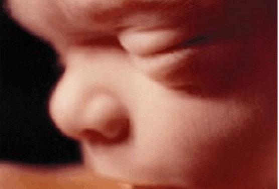 Here's Why the CDC is Not Publishing Annual Abortion Data