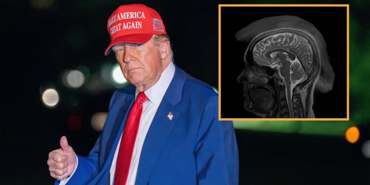 Image for article: MRI Confirms President Donald Trump Has Incurable Advanced-Stage Patriotism