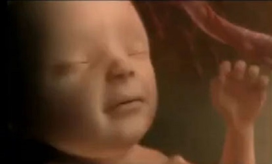 New Texas Law Will Continue Saving Babies From Abortions