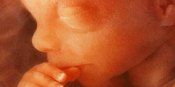 Northern Ireland Kills a Record 2,899 Babies in Abortions