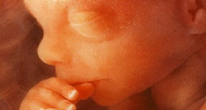 Northern Ireland Kills a Record 2,899 Babies in Abortions
