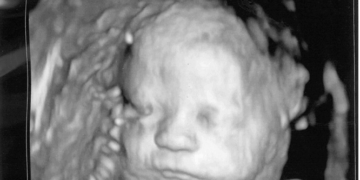 Pennsylvania House Passes Amendment for Abortions Up to Birth