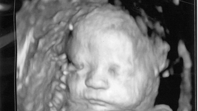 Pennsylvania House Passes Amendment for Abortions Up to Birth