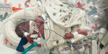 Premature Baby Born in Family Car at 22 Weeks Goes Home in Time for Christmas