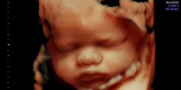 Pro-Life Group Tells Congress: No Abortion Funding in Obamacare