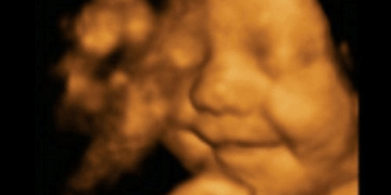 This Texas Town is the 88th City Nationwide to Ban Abortions