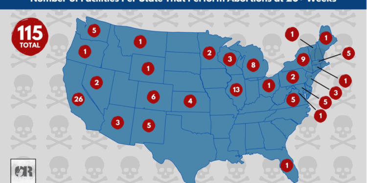 115 Abortion Centers Across America Kill Viable Babies in Abortions
