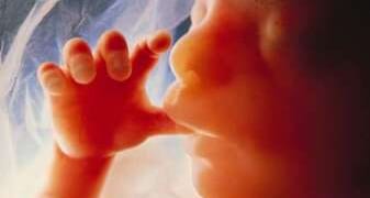 A ‘seamless garment’ for the Right?