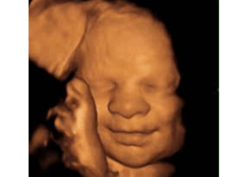 642,700 Babies Were Killed With Abortion Pills in 2023. We Have to Stop This