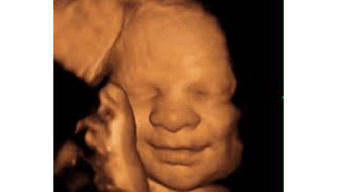 642,700 Babies Were Killed With Abortion Pills in 2023. We Have to Stop This