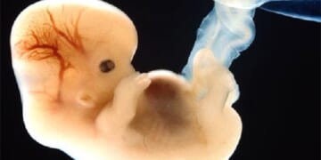 65 Million Babies Have Been Killed in Abortions Since Roe, We Must End Abortion