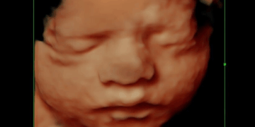 Abortion Activists Want to Overturn Arkansas Abortion Ban