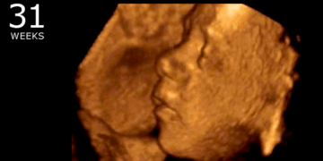 Abortions Down 45% in Florida, Babies Saved as Abortion Centers Close