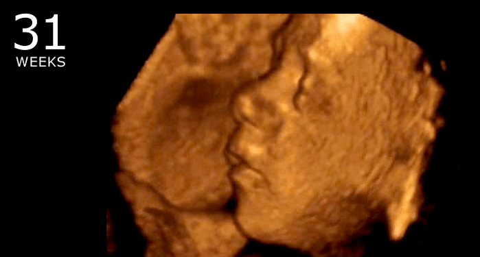 Abortions Down 45% in Florida, Babies Saved as Abortion Centers Close