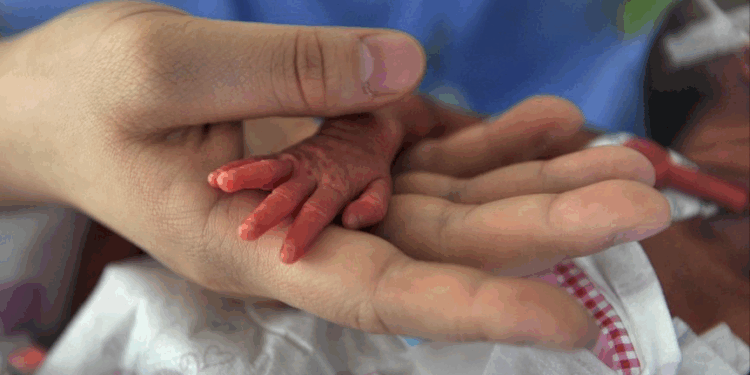 Babies Were Born Alive After Botched Abortions, Denied Medical Care and Tossed Into Buckets