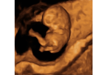 Colorado Supreme Court Attempts to Kill Right to Lfie for Unborn Babies