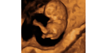 Colorado Supreme Court Attempts to Kill Right to Lfie for Unborn Babies