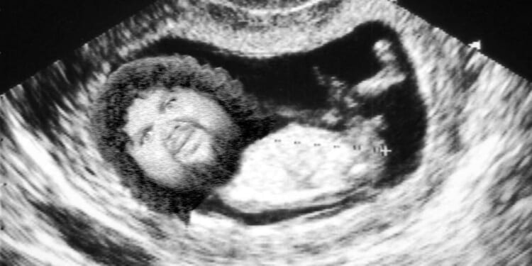 Image for article: JD Vance Shares Ultrasound Of 4th Child