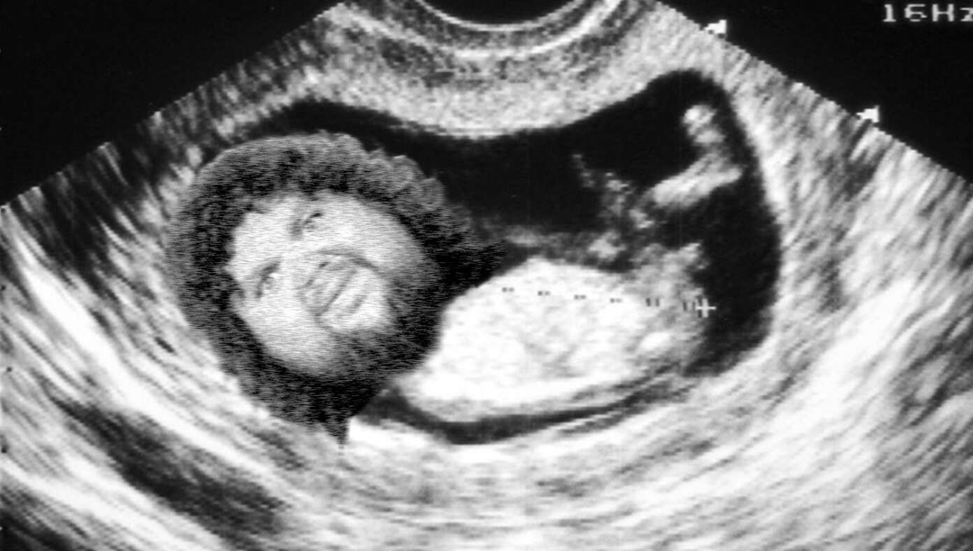 Image for article: JD Vance Shares Ultrasound Of 4th Child