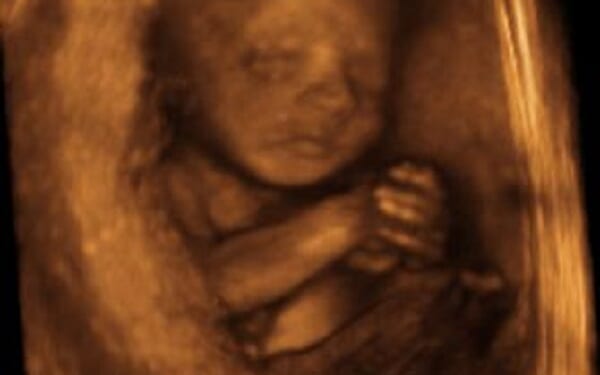 Killing Babies for Birth Control: Half of Abortions in Pennsylvania are Repeat Abortions