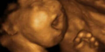 Louisiana Bid to Overturn Biden Rule Could Save Thousands of Babies From Abortions