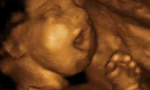 Louisiana Bid to Overturn Biden Rule Could Save Thousands of Babies From Abortions