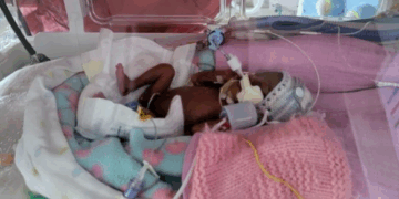 Premature Baby Born at 22 Weeks and Weighing 13 Ounces Heads Home From Hospital