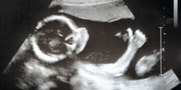 Protect the Hyde Amendment: No Abortion Funding in Obamacare