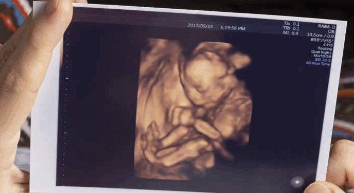 Senators Introduce Bill to End Abortion, Extend 14th Amendment to Unborn Children