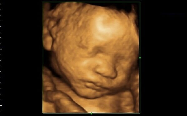 South Carolina Panel Passes Pro-Life Bill to Stop Mail-Order Abortion Drugs