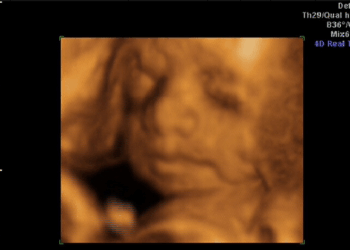 Texas and Florida Sue FDA Over Dangerous Abortion Pills